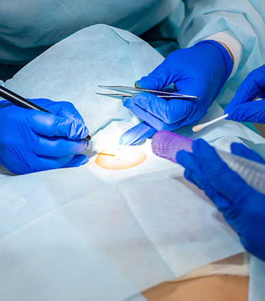 Minor ENT Procedures