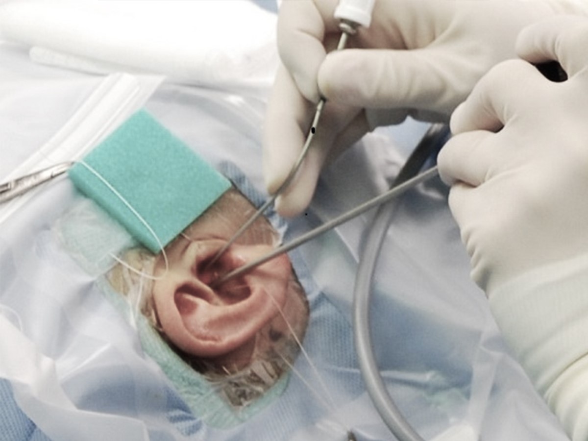 best microscopic ear surgeon in kopar khairane